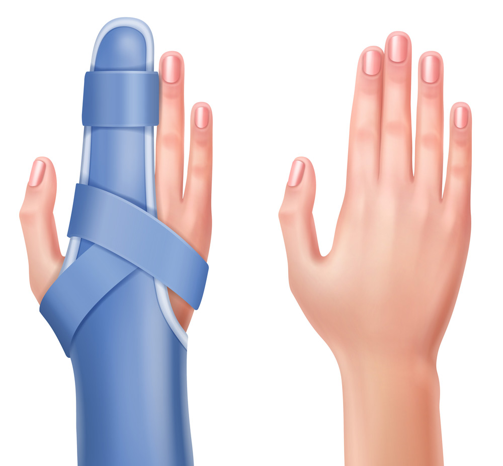 operacja ścięgna palca ręki
